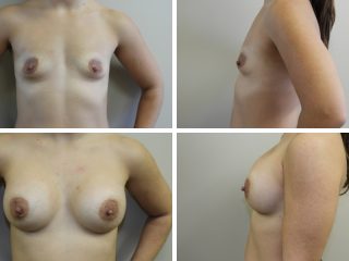 dr stephen paulsen tulsa plastic surgeon