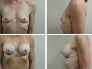 dr stephen paulsen before and after